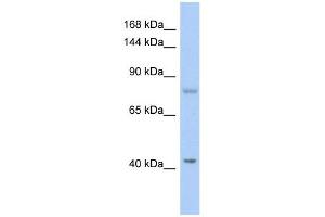 SH2D3C antibody used at 1 ug/ml to detect target protein. (SH2D3C antibody  (N-Term))