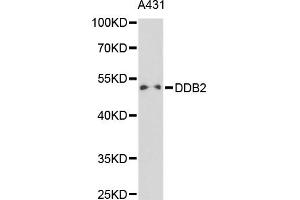 Western blot analysis of extracts of A-431 cells, using DDB2 antibody (ABIN5970947) at 1/1000 dilution. (DDB2 antibody)