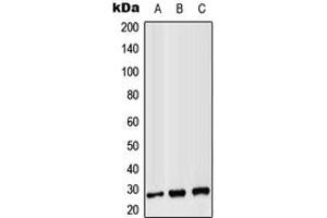 Western blot analysis of CD8b expression in Jurkat (A), Raw264. (CD8B antibody  (Center))