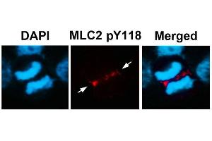 Immunofluorescence staining of methanol-fixed U87 cells using MLC2 (Phospho-Tyr118) Antibody. (MYL9 antibody  (pTyr118))