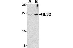 Western blot analysis of IL-32 in Jurkat cell lysate with AP30425PU-N IL-32 antibody at (A) 2.