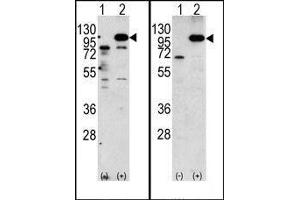 (LEFT)Western blot analysis of APP (arrow) using rabbit polyclonal APP Antibody (N-term).