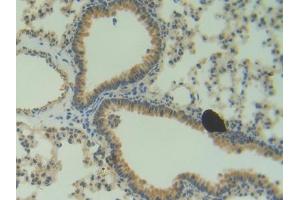 DAB staining on IHC-P; Samples: Mouse Lung Tissue (ANG antibody  (AA 25-145))