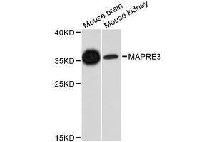 Western blot analysis of extracts of various cell lines, using MAPRE3 antibody. (MAPRE3 antibody)