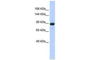 Image no. 1 for anti-phosphodiesterase 3A, cGMP-Inhibited (PDE3A) (AA 360-409) antibody (ABIN6743295) (PDE3A antibody  (AA 360-409))