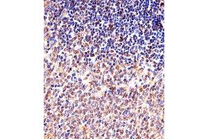 Immunohistochemical analysis of paraffin-embedded M. (Cyclin B1 antibody  (AA 103-130))