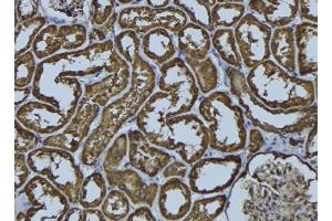 ABIN6278976 at 1/100 staining Rat kidney tissue by IHC-P. (ACAA2 antibody  (Internal Region))