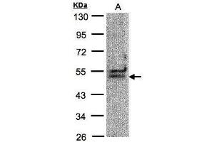 WB Image Sample(30 μg of whole cell lysate) A:Hep G2, 10% SDS PAGE antibody diluted at 1:1000