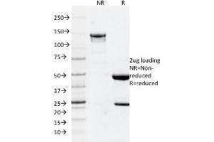 SDS-PAGE Analysis Purified GFAP Mouse Monoclonal Antibody (GFAP/2076). (GFAP antibody  (AA 101-200))