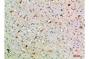 Immunohistochemical analysis of paraffin-embedded human-brain, antibody was diluted at 1:200 (SEMA7A antibody  (AA 101-150))