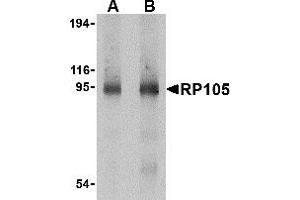 Western Blotting (WB) image for anti-CD180 Molecule (CD180) (C-Term) antibody (ABIN1030626) (CD180 antibody  (C-Term))