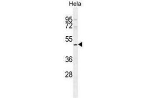 SMYD1 Antibody (C-term) western blot analysis in Hela cell line lysates (35µg/lane). (SMYD1 antibody  (C-Term))