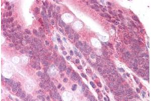 Human Small Intestine: Formalin-Fixed, Paraffin-Embedded (FFPE) (MEK2 antibody  (N-Term))