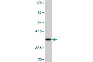 Western Blot detection against Immunogen (36. (S100A7 antibody  (AA 1-101))