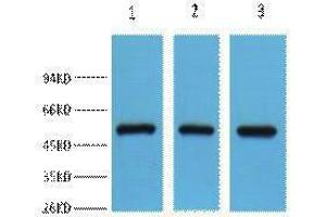 Western Blotting (WB) image for anti-Fumarate Hydratase (FH) antibody (ABIN3181264) (FH antibody)