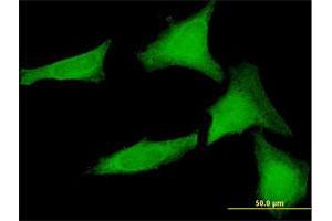Immunofluorescence of purified MaxPab antibody to SGTA on HeLa cell. (SGTA antibody  (AA 1-313))