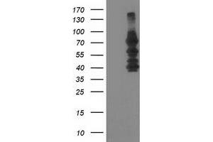 Western Blotting (WB) image for anti-Katanin P80 (WD Repeat Containing) Subunit B 1 (KATNB1) antibody (ABIN1498991) (KATNB1 antibody)