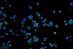 IF analysis of TRPV1 using anti-TRPV1 antibody (ABIN7599677).