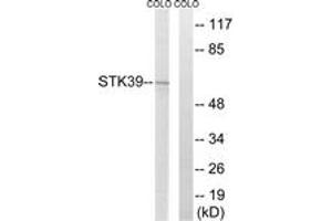 Western blot analysis of extracts from COLO205 cells, using STK39 Antibody. (STK39 antibody  (AA 351-400))