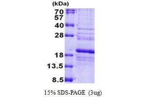 SDS-PAGE (SDS) image for Ribosomal Protein S24 (RPS24) (AA 1-130) protein (His tag) (ABIN6387241) (RPS24 Protein (AA 1-130) (His tag))