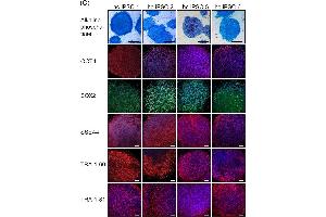 Immunofluorescence (Cultured Cells) (IF (cc)) image for anti-SRY (Sex Determining Region Y)-Box 2 (SOX2) antibody (ABIN2855074)