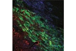 Multiplex staining of KCa3. (KCNN4 antibody  (Extracellular))