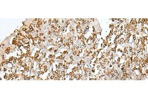 Immunohistochemistry of paraffin-embedded Human tonsil tissue using SEPT1 Polyclonal Antibody at dilution of 1:50(x200) (Septin 1 antibody)