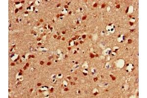 Immunohistochemistry of paraffin-embedded human brain tissue using ABIN7153026 at dilution of 1:100 (FOXC2 antibody  (AA 24-294))