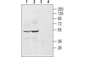 Western blot analysis of mouse (lanes 1 and 3) and rat (lanes 2 and 4) brain lysates: - 1, 2. (ADRA2A antibody  (Extracellular, N-Term))