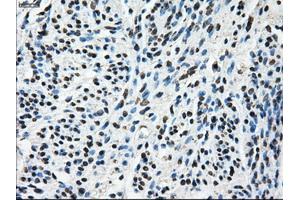 Immunohistochemical staining of paraffin-embedded Ovary tissue using anti-TTLL12mouse monoclonal antibody. (TTLL12 antibody)
