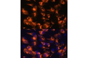 Immunofluorescence analysis of C6 cells using Somatostatin Receptor 2 (SSTR2) Polyclonal Antibody (ABIN7270493) at dilution of 1:100 (40x lens). (SSTR2 antibody  (C-Term))