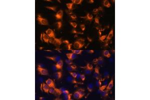 Immunofluorescence analysis of C6 cells using Somatostatin Receptor 2 (SSTR2) Polyclonal Antibody (ABIN7270493) at dilution of 1:100 (40x lens). (SSTR2 antibody  (C-Term))