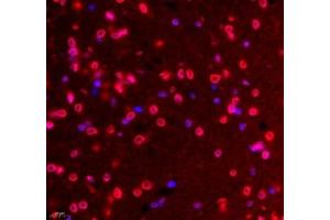 Immunofluorescence of paraffin embedded rat hippocampus using Tuba3a (ABIN7076051) at dilution of 1: 600 (400x lens (Tuba3a antibody)