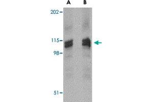 Western blot analysis of DLGAP3 in rat brain tissue lysate with DLGAP3 polyclonal antibody  at (A) 1 (B) 2 ug/mL . (DLGAP3 antibody  (C-Term))