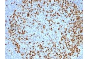 IHC testing of FFPE human tonsil with TOP2A antibody (clone TOP2A/1362). (Topoisomerase II alpha antibody  (AA 1352-1493))