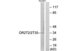 Western blot analysis of extracts from HuvEc cells, using OR2T2/2T35 Antibody. (OR2T2/2T35 antibody  (AA 201-250))