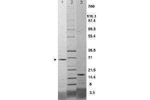IL-17F Rat Recombinant Protein - SDS-PAGE.