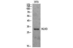 Western Blotting (WB) image for anti-Prostate Specific Antigen (PSA) (Internal Region) antibody (ABIN3181406)