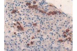 Detection of TUBd in Mouse Pancreas Tissue using Polyclonal Antibody to Tubulin Delta (TUBd) (TUBD1 antibody  (AA 236-455))