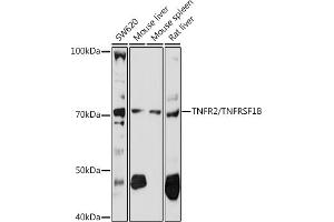 Western blot analysis of extracts of various cell lines, using TNFR2/TNFRSF1B antibody (ABIN3021423, ABIN3021424, ABIN3021425 and ABIN6215025) at 1:1000 dilution. (TNFRSF1B antibody)