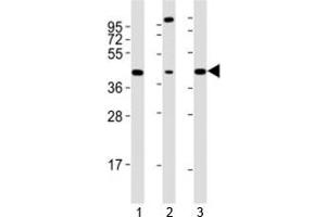 Western blot testing of Sox17 antibody at 1:2000 dilution. (SOX17 antibody  (AA 350-400))