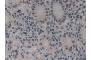Immunohistochemistry (IHC) image for anti-Insulin-Like Growth Factor Binding Protein 1 (IGFBPI) (AA 36-235) antibody (ABIN7442780)