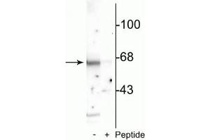 Western blot of rat cortical lysate showing specific immunolabeling of the ~65 kDa Munc-18 protein phosphorylated at Ser513 in the first lane (-). (STXBP2 antibody  (pSer513))