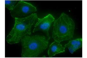 ICC/IF analysis of CASQ2 in HeLa cells line, stained with DAPI (Blue) for nucleus staining and monoclonal anti-human CASQ2 antibody (1:100) with goat anti-mouse IgG-Alexa fluor 488 conjugate (Green). (CASQ2 antibody)