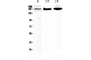 Western blot analysis of SUR1 using anti-SUR1 antibody . (ABCC8 antibody)