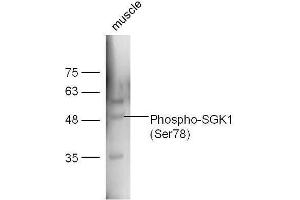 Mouse muscle lysates probed with Rabbit Anti-SGK1 (Ser78) Polyclonal Antibody, Unconjugated  at 1:5000 for 90 min at 37˚C.