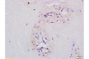 Immunohistochemistry (Paraffin-embedded Sections) (IHC (p)) image for anti-Major Facilitator Superfamily Domain Containing 2A (MFSD2A) (AA 331-430) antibody (ABIN762026)