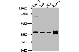 Western Blot Positive WB detected in: HepG2 whole cell lysate, 293 whole cell lysate, PC3 whole cell lysate, Rat brain tissue All lanes: RFNG antibody at 1:2000 Secondary Goat polyclonal to rabbit IgG at 1/50000 dilution Predicted band size: 37 kDa Observed band size: 37 kDa (RFNG antibody  (AA 71-331))