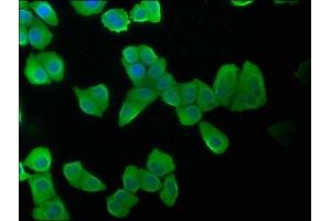Immunofluorescence staining of Hela cells with ABIN7157400 at 1:100, counter-stained with DAPI. (Keratin 2 antibody  (AA 207-424))