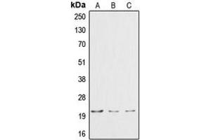 Western blot analysis of Cardiotrophin-1 expression in HepG2 (A), HeLa (B), Jurkat (C) whole cell lysates.